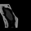SPORK, NICO - 22.03.1976 - 02.08.2022 - CT obere Extremität - 18:01:46